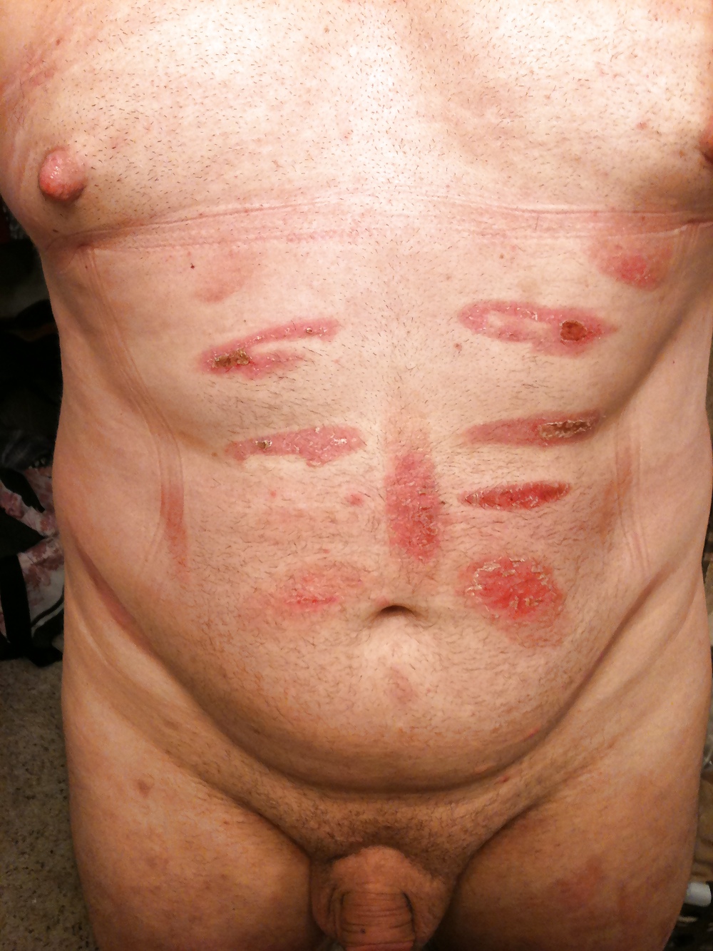 Toys and Marks from my Vacation with Mistress #4100501