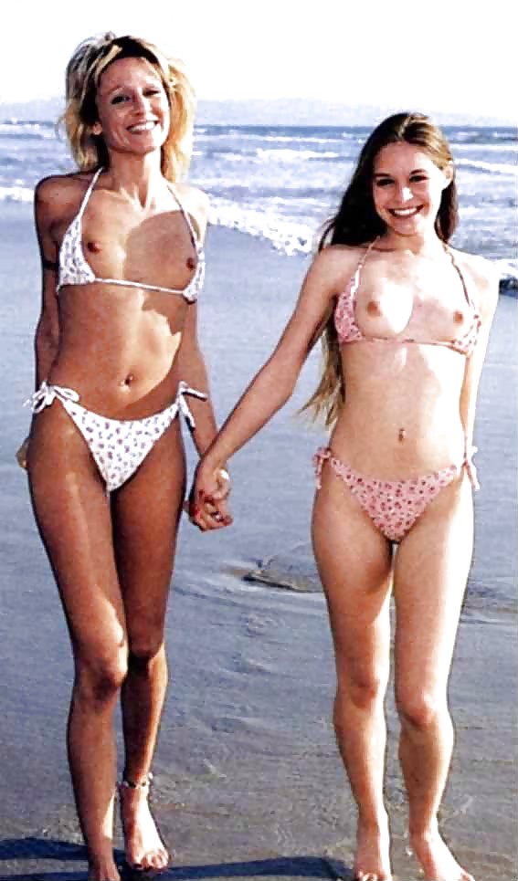 Who wins Mother and Daughter vs Before and After? #7153912