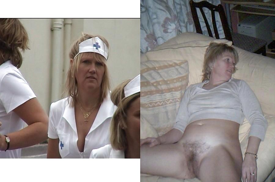 Before - After 9. #1149187