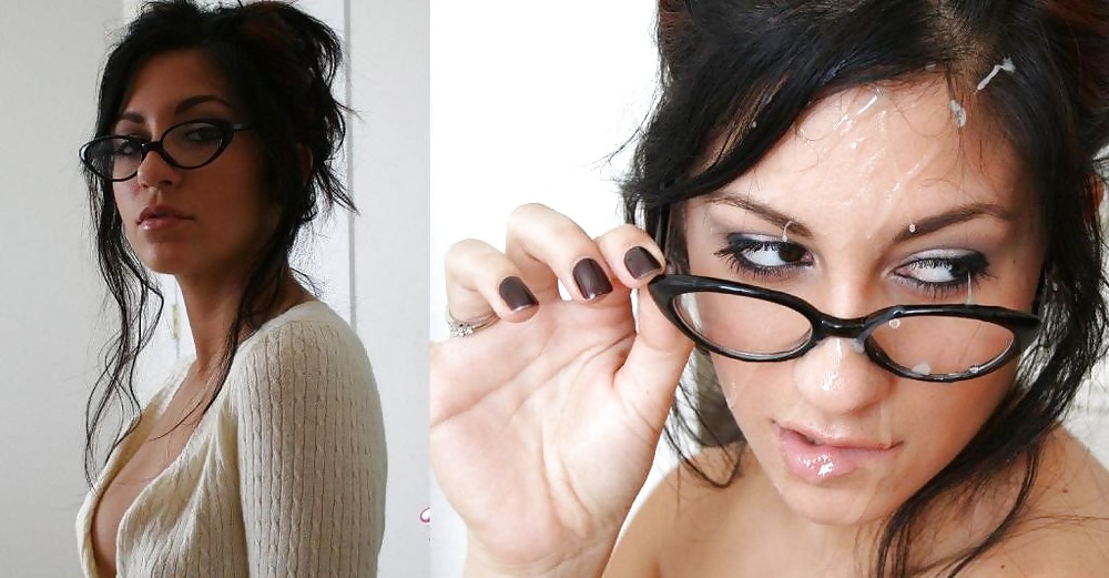 Before - After 9. #1149307