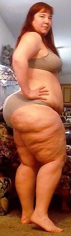 For Cellulite Lovers Only #2239402
