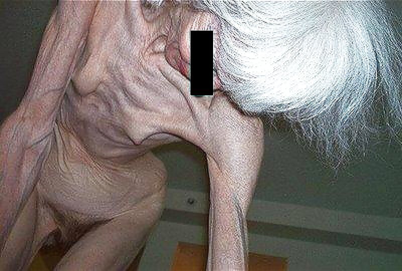 EXTREMELY SKINNY AND VERY OLD HAIRY GRANNY #15429374