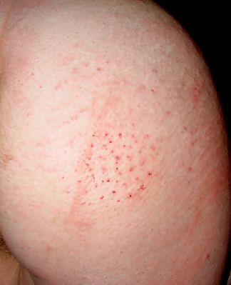 Compilation of mixed spanking session pictures #301599