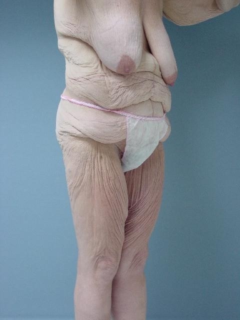 Older Grannies and matures showing their wrinkled bodies #67569795