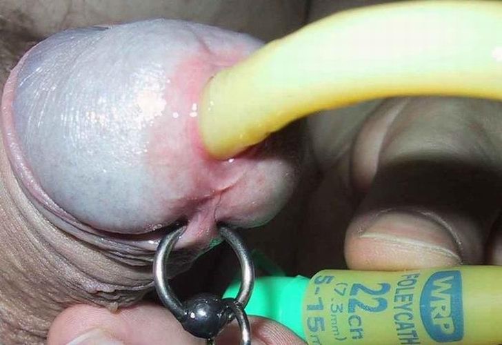 Extremely Object Insertions In Penis #71980569