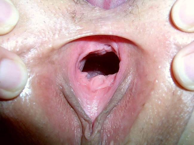 extreme homemade fisting and objects insertions #73221354